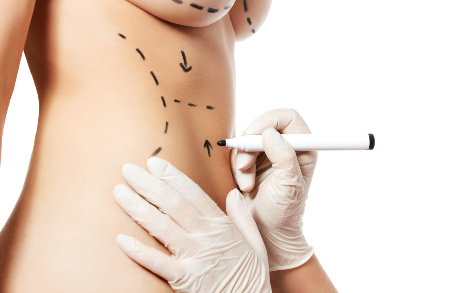 cosmetic surgery financing
